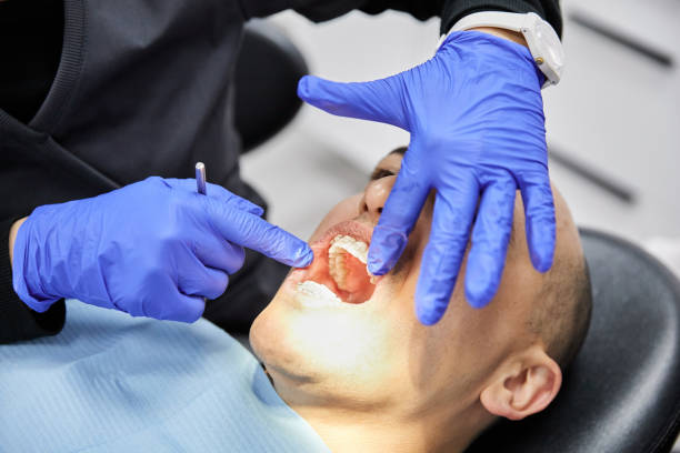 Best Emergency Wisdom Teeth Removal in Woodcreek, TX